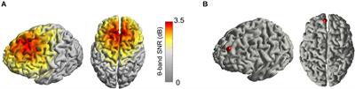 Prefrontal Theta-Phase Synchronized Brain Stimulation With Real-Time EEG-Triggered TMS